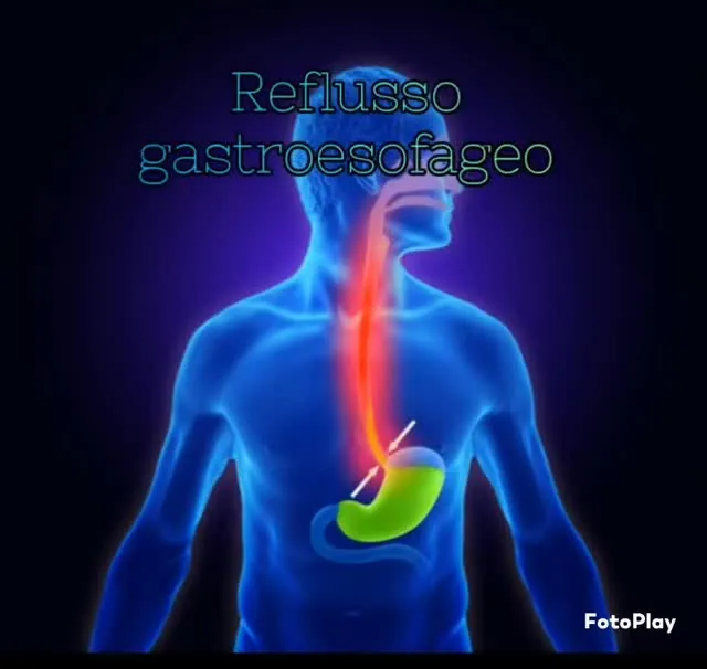 Alimentazione e reflusso gastroesofageo: cosa mangiare e cosa evitare